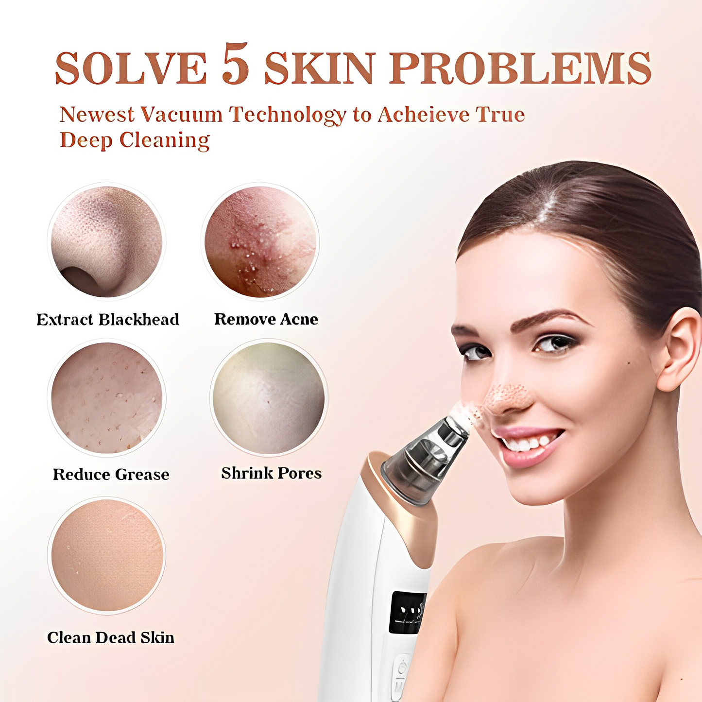 Electric Blackhead & Acne Remover: Advanced Technology for Clearer Complexions